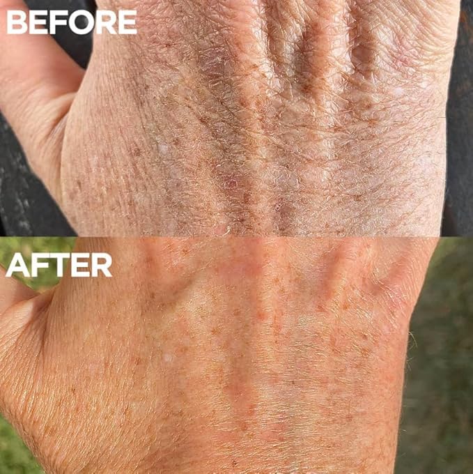 Golden Skin Salve