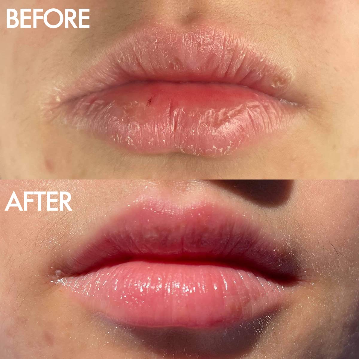 Lanolips Lip Balm Basic